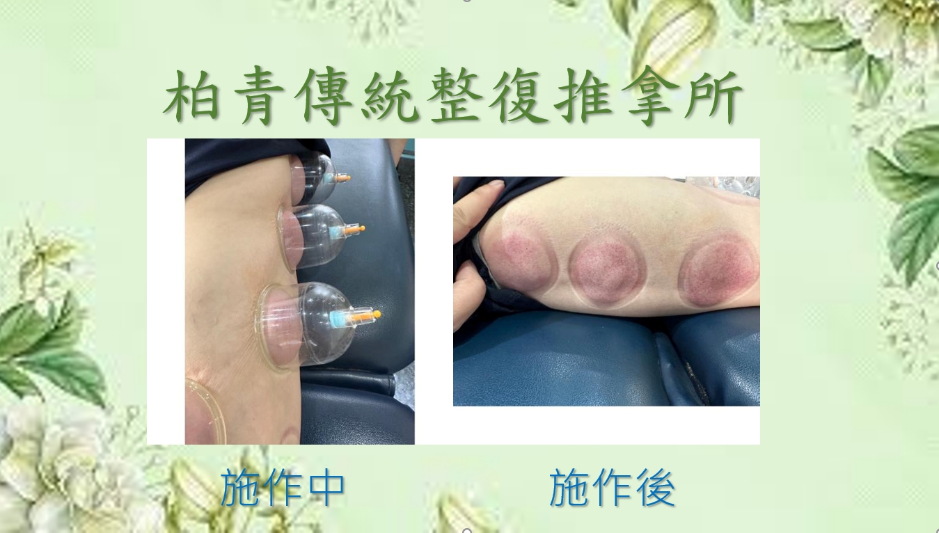 前後對照